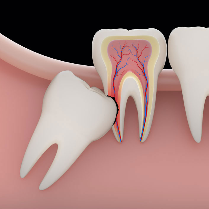 Oral Surgery Referrals - Dental Services