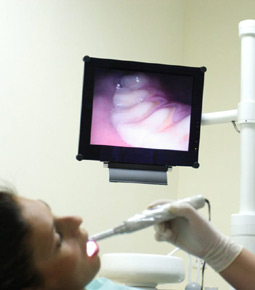 IntraOral Camera - Dental Technology